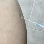 vaccino-covid-astrazeneca